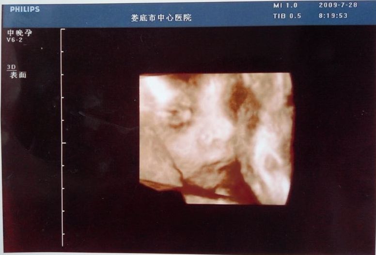 20090728第一次见面